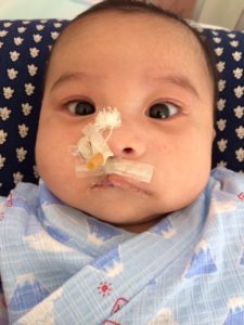 左側の鼻のチューブも取れました