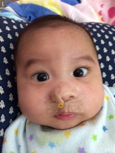 オペ後6日で抜糸しました。