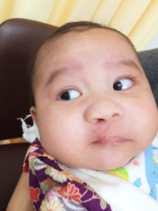 診察のためテープとお鼻のチューブを取ったところ。