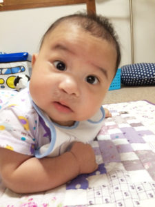 茶色のテープはしばらく貼ってくださいと言われました。。